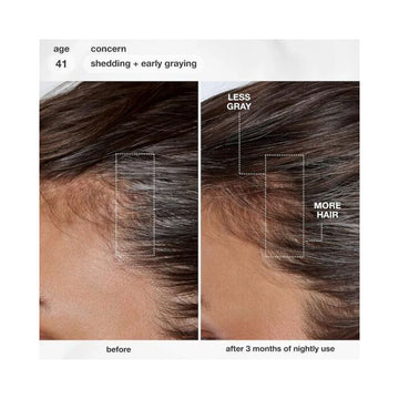 K18 FutureIQ™ biomimetic hair longevity serum 90ML